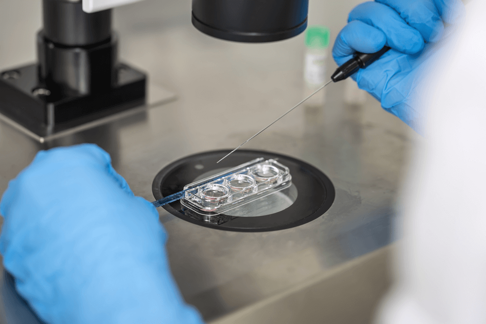 Manipulation d’ovocytes sous microscope en laboratoire, avant congélation ovocytaire dans le cadre d’un parcours d’AMP ou de préservation de la fertilité.